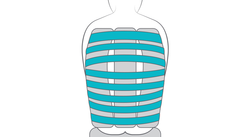 Card item -Back straps - Kyphosis Prio3A