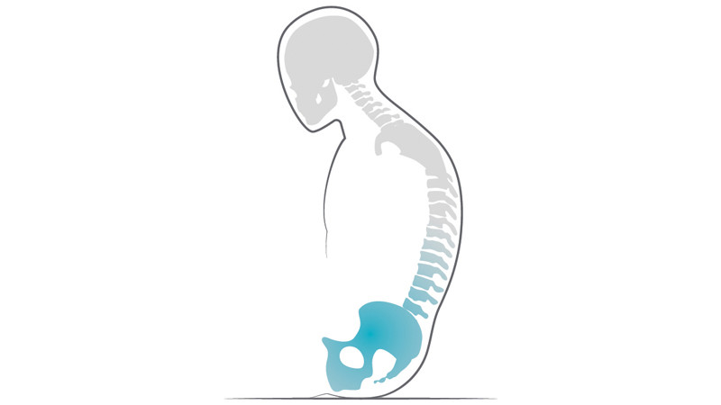 Card item block - Body shape Tilted pelvis Prio 3A